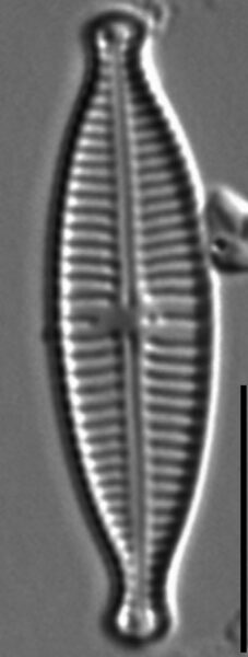 Gomphonema Lagenula LM3