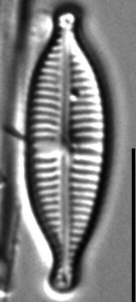 Gomphonema Lagenula LM7