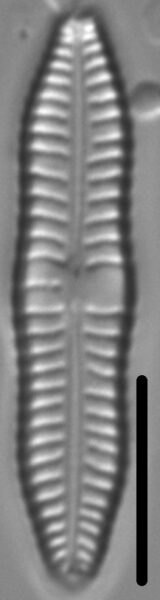 Gomphonema distans LM6