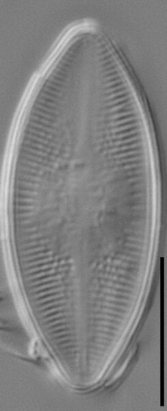 Psammothidium lacustre LM1