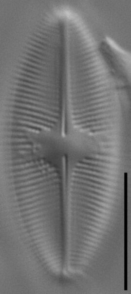 Psammothidium lacustre LM5