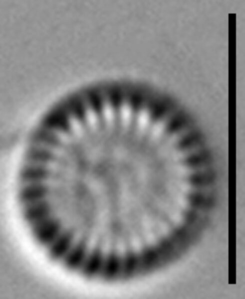 Lindavia comensis LM5