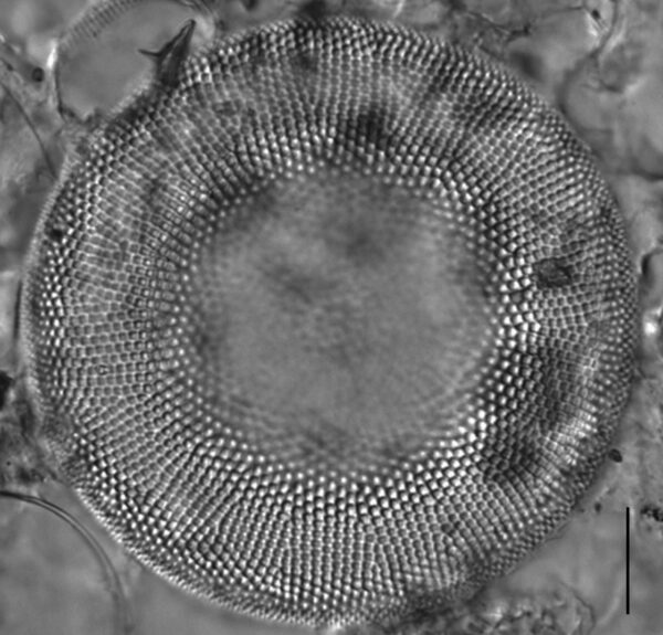 Actinocyclus normanii_LM4