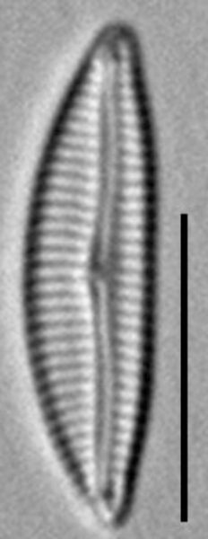 Encyonema evergladianum LM6