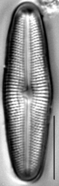 Muelleria gibbula LM7