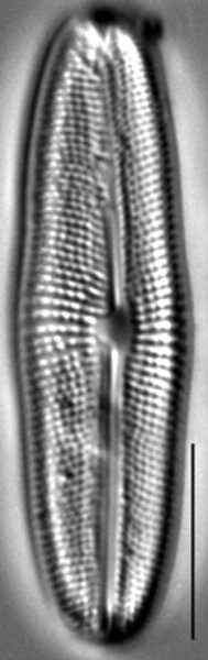 Muelleria gibbula LM5