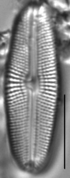 Muelleria gibbula LM3