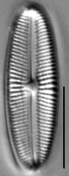 Muelleria gibbula LM2