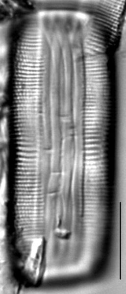 Muelleria gibbula LM1