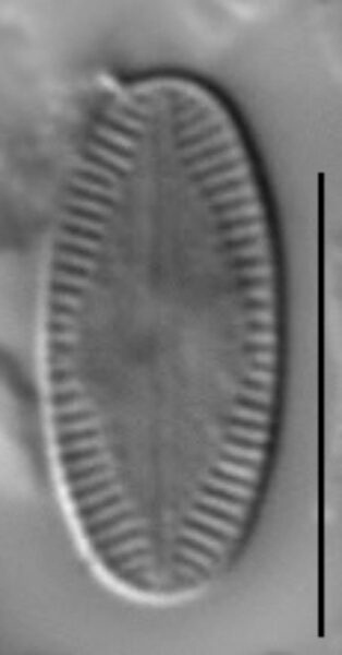 Psammothidium acidoclinatum LM3