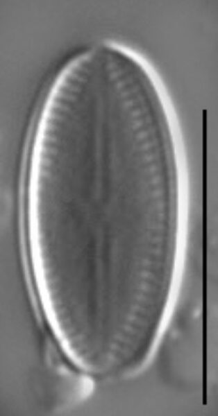 Psammothidium acidoclinatum LM2