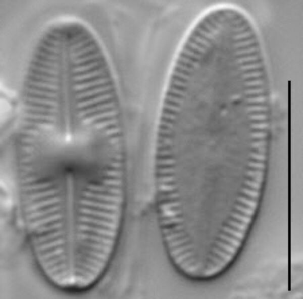 Psammothidium acidoclinatum LM5