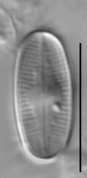 Psammothidium scoticum LM2