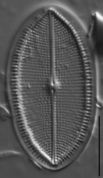 Cocconeis placentula LM1