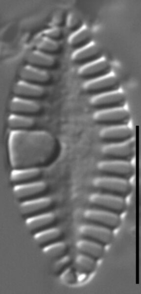 Planothidium abbreviatum LM1