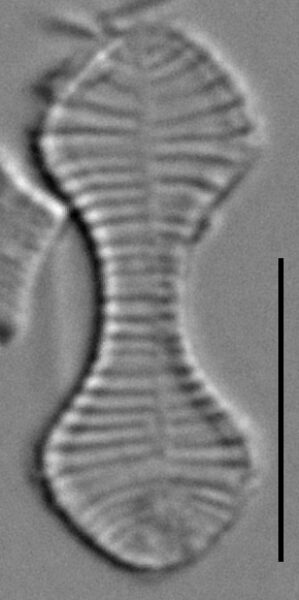 Oxyneis binalis LM7