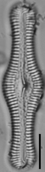 Pinnularia turgidula LM3