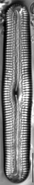 Pinnularia acrosphaeria LM2