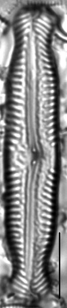 Pinnularia nodosa var percapitata LM2