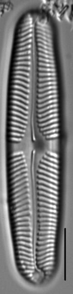 Pinnularia rhombarea LM3