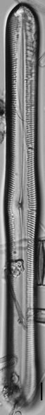 Pinnularis transversa LM7