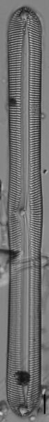 Pinnularis transversa LM1