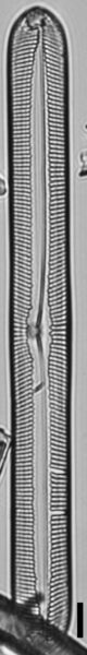 Pinnularis transversa LM4