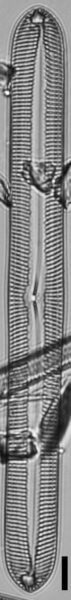 Pinnularis transversa LM3