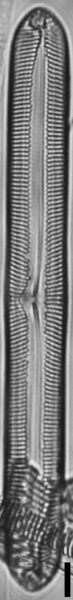 Pinnularis transversa LM5