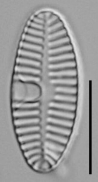 Planothidium Sheathii Lm03