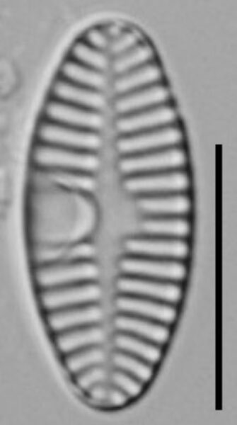 Planothidium Sheathii Lm05