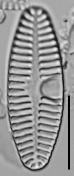 Planothidium Sheathii Lm10