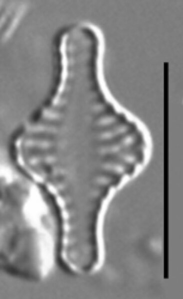 Pseudostaurosira pseudoconstruens LM7