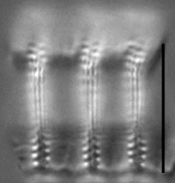 Pseudostaurosira pseudoconstruens LM1