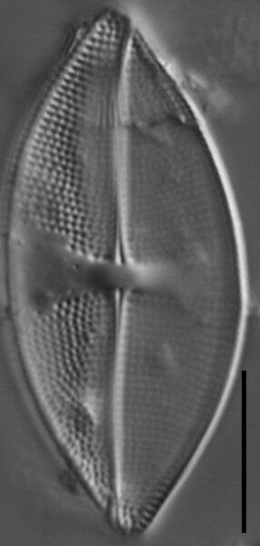 Psammothidium obliquum LM3