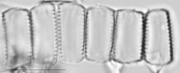 Pseudostaurosira neoelliptica LM2