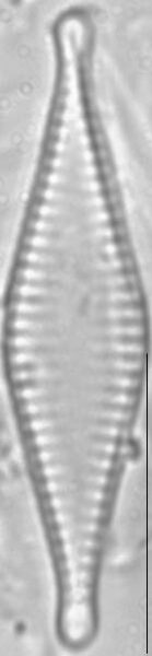 Pseudostaurosira parasitica LM1