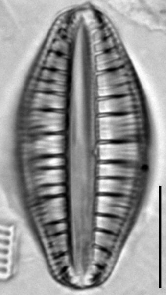 Rhopalodia gibberula LM10