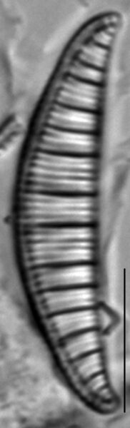 Rhopalodia gibberula LM8