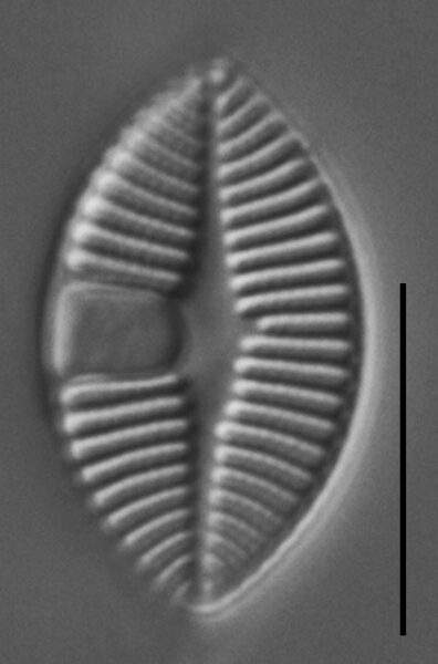 Skabitschewskia oestrupii LM2