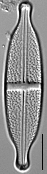 Stauroneis lauenburgiana LM3