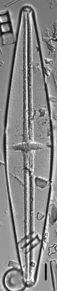 Stauroneis phoenicenteron LM3