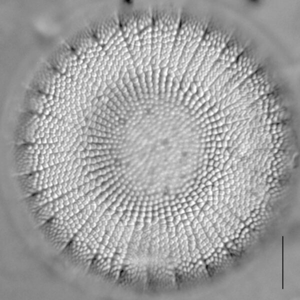 Stephanodiscus reimeri LM4