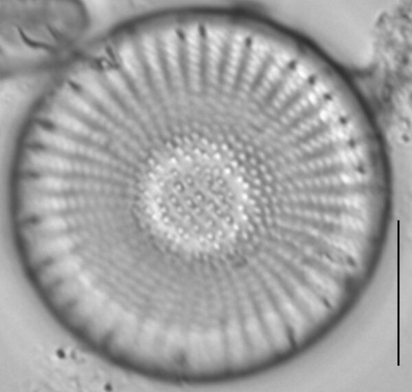 Stephanodiscus medius LM3