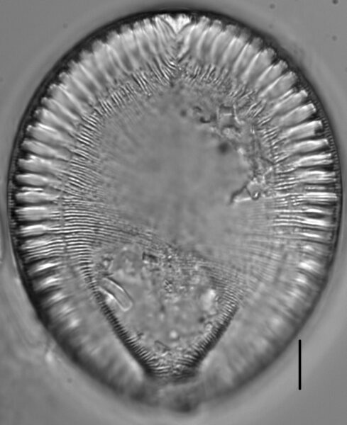 Surirella crumena LM7