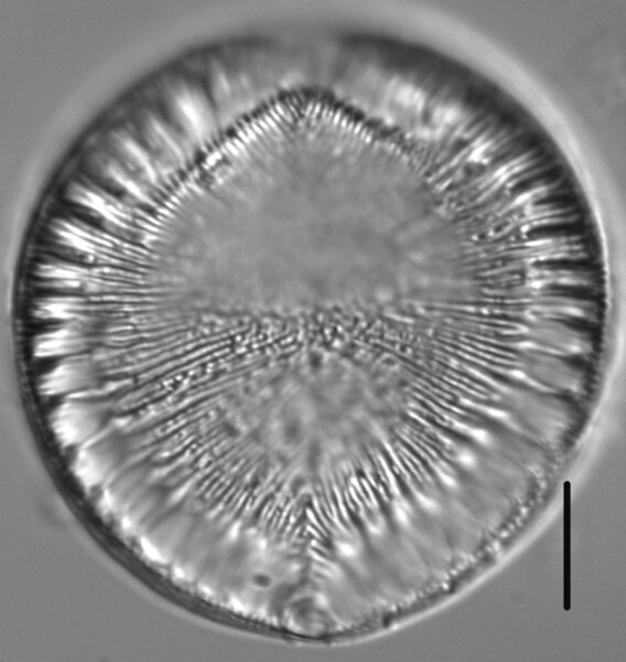 Surirella crumena LM4