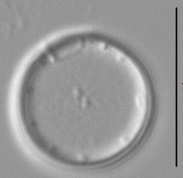 Thalassiosira minima LM2