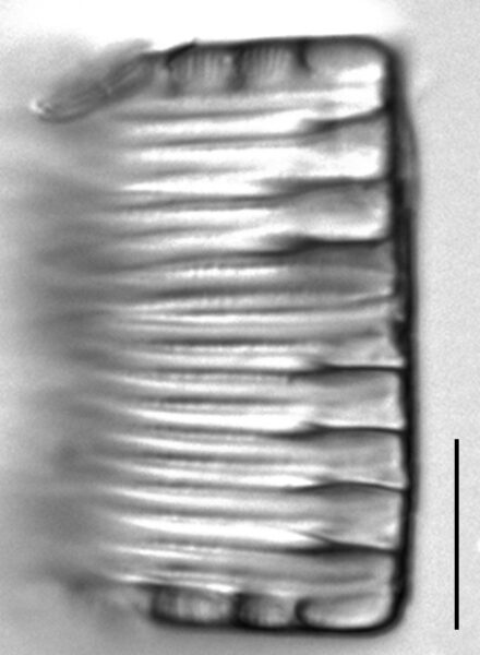 Tetracyclus hinziae LM6