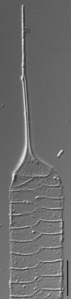 Urosolenia Eriensis Lm6