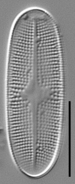 Psammothidium alpinum LM3